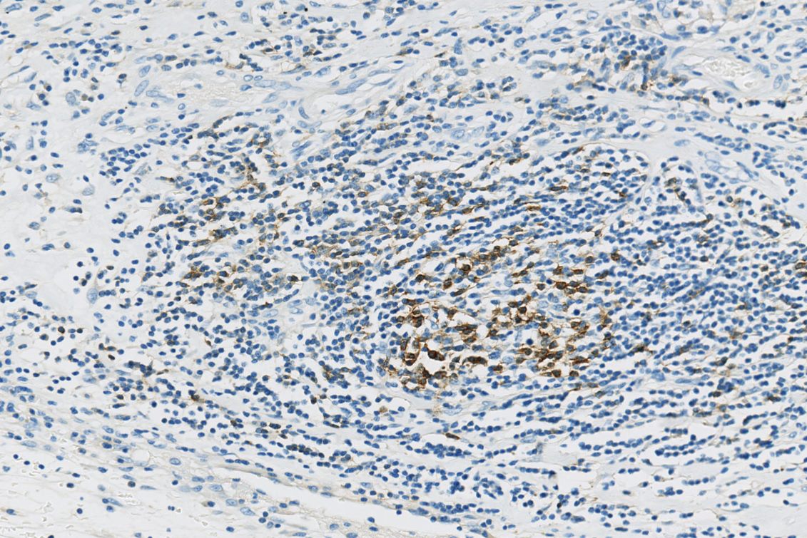 IHC, Histopathology