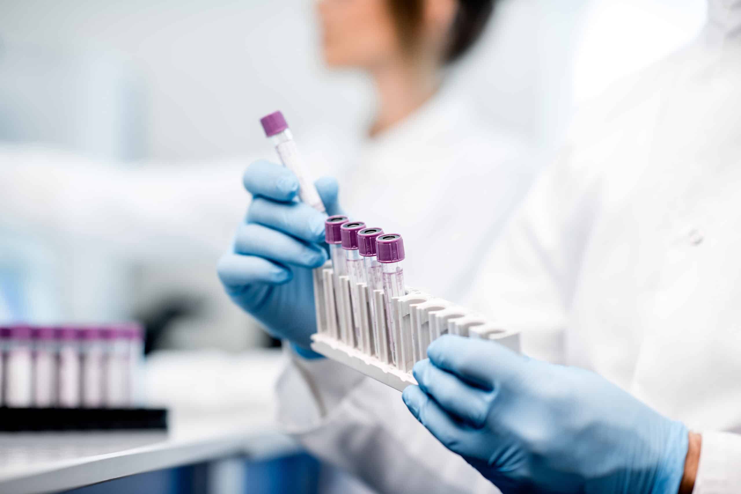 An image of two scientists in a lab. The image is focusing on a scientist withdrawing a test tube from a test tube rack