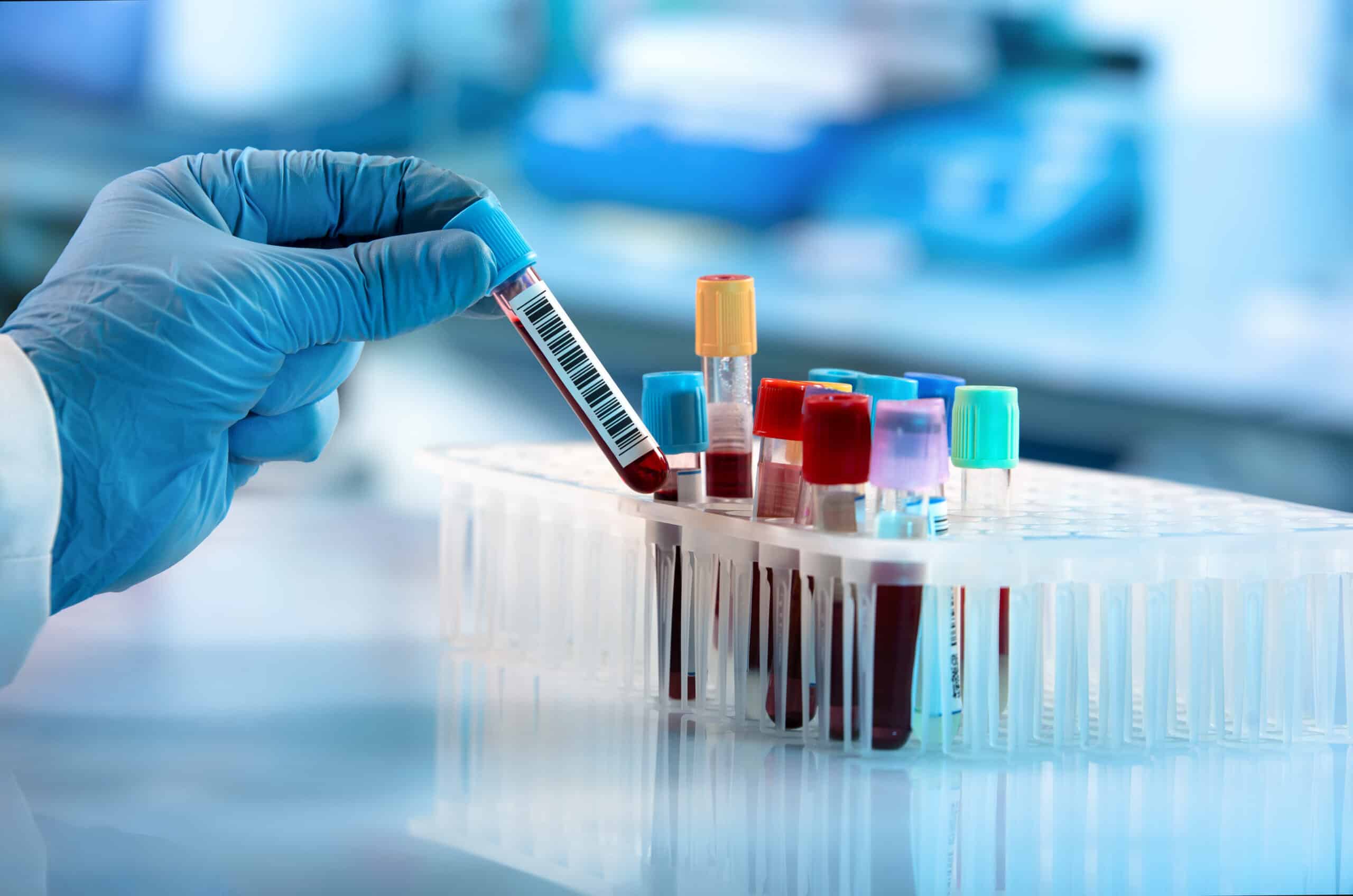 A close-up image of a scientist picking up a vial of blood from a test tube rack