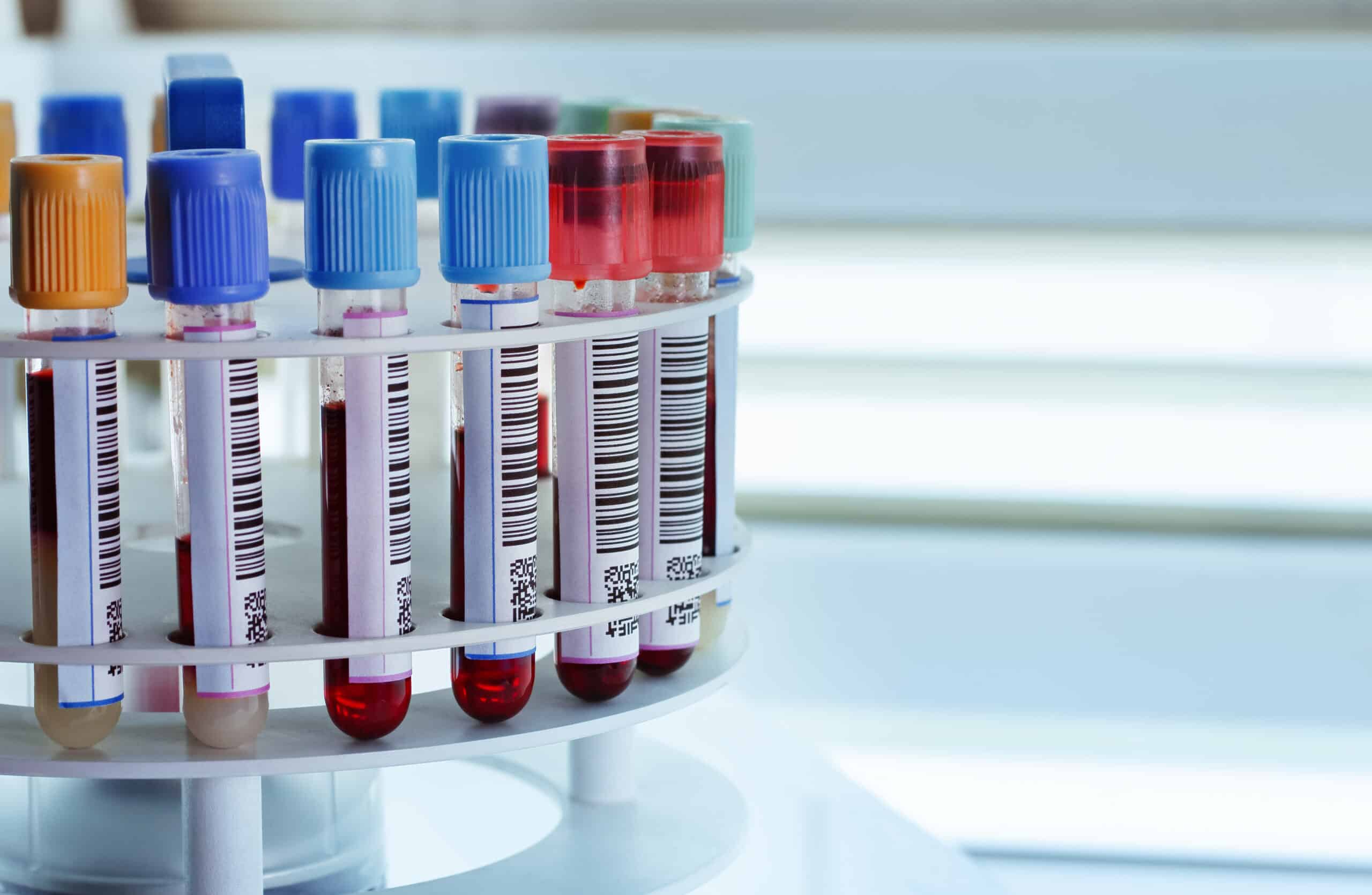 A test tube rack full of test tube vials containing blood.