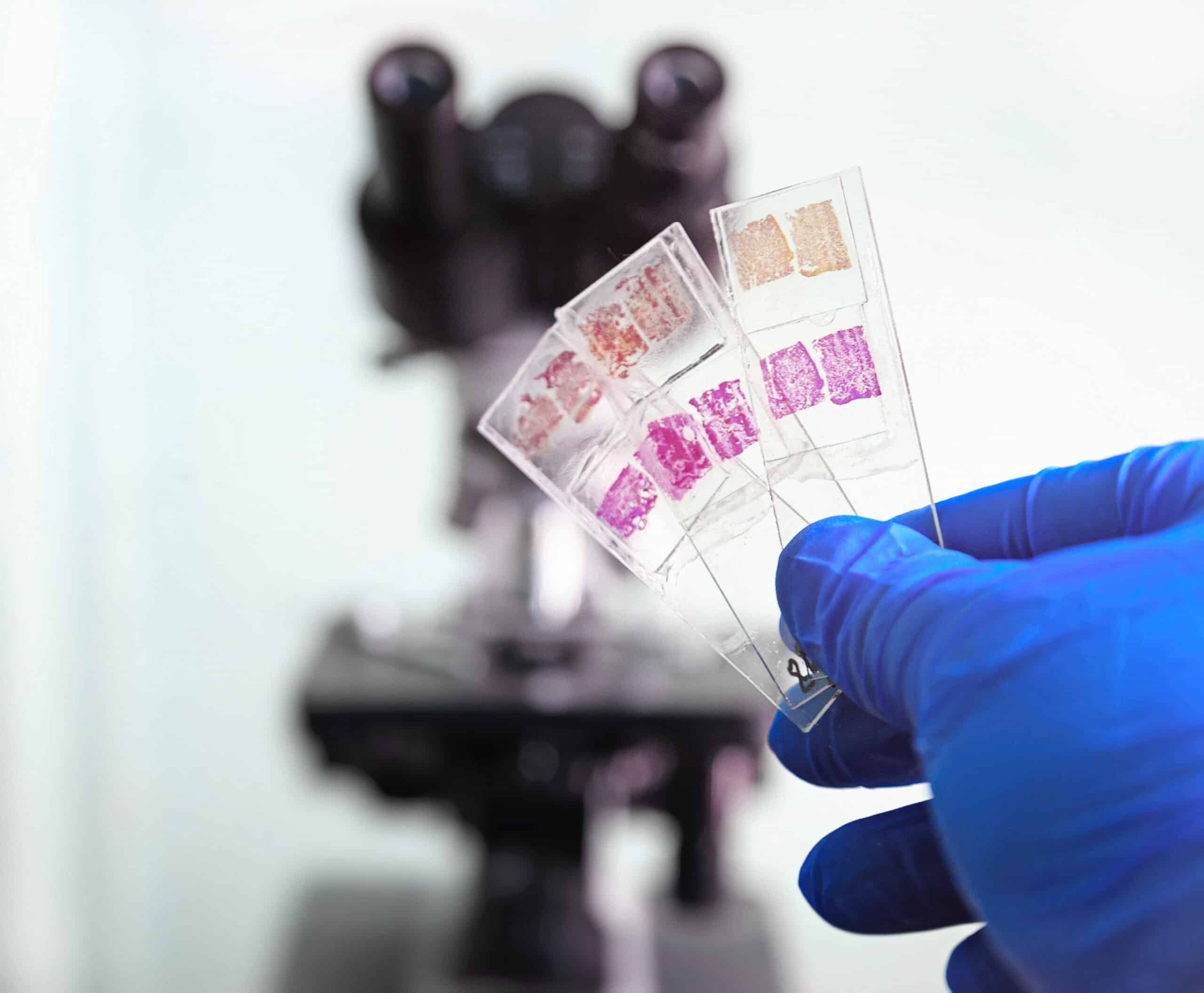 A hand holds three glass slides with stained samples on them in front of a microscope