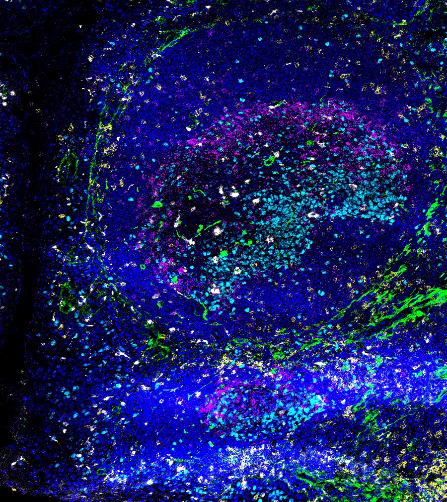 IF Staining of human tonsillitis tissue using CoraLite®594 human IgM antibody