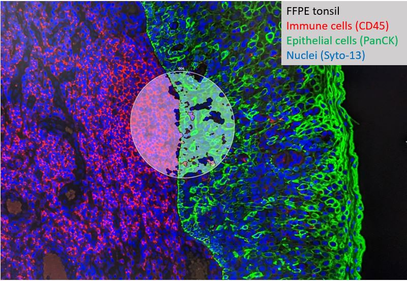 a snapshot image of Cerba Research’s spatial omics nanostring