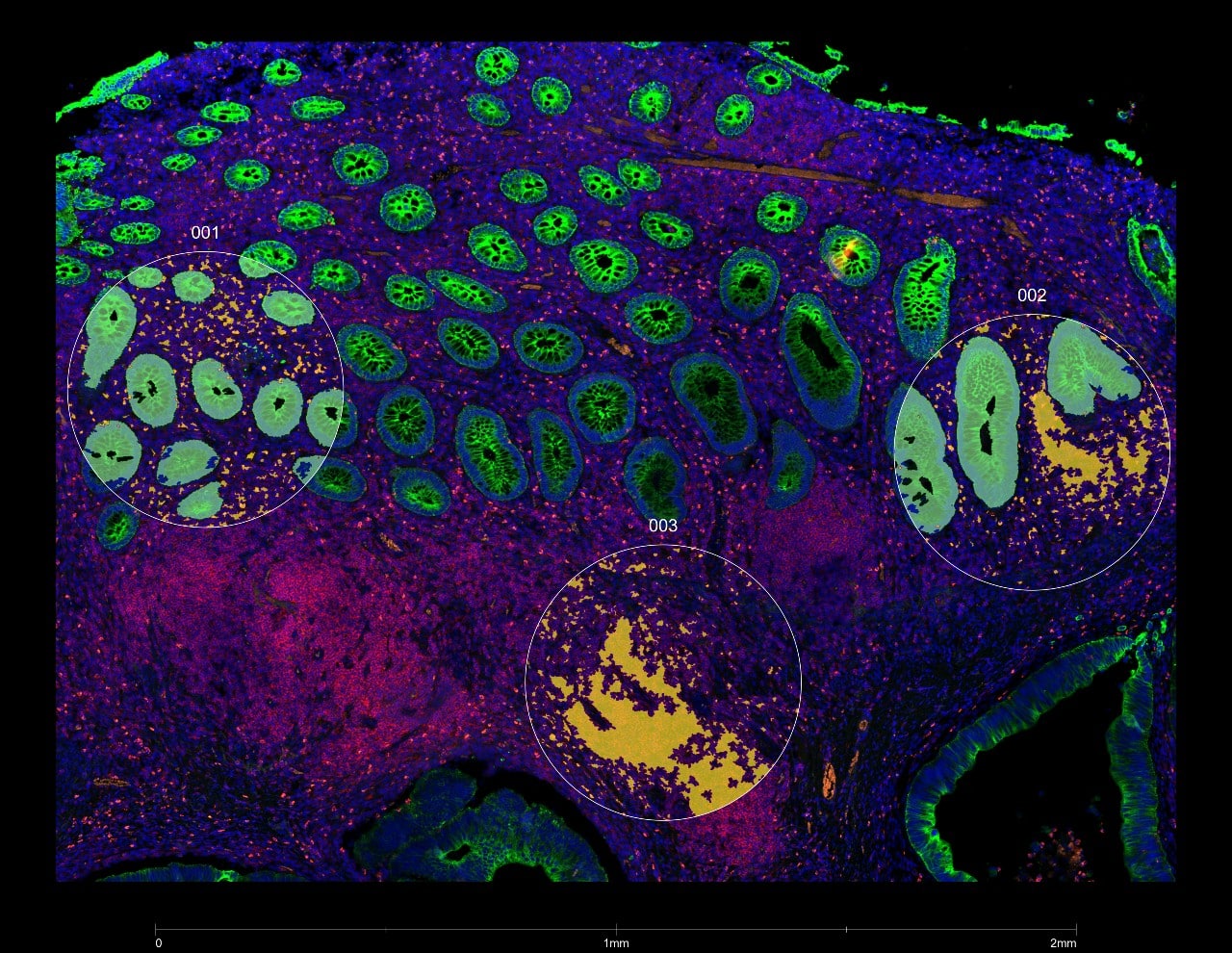 A snapshot of Cerba Research’s NanoString™ GeoMx® proteomic profiling.